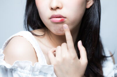 唇が荒れている女性