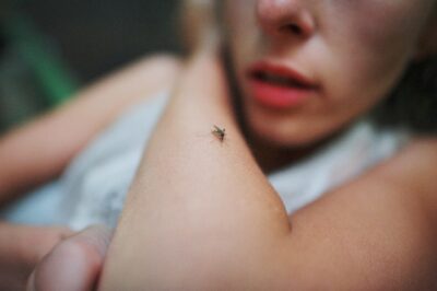 蚊に刺された女性